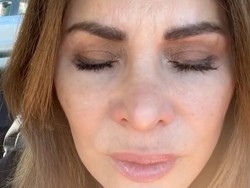 Penampilan Wanita yang Berhenti Suntik Botox Setelah 20 Tahun, Jadi Begini