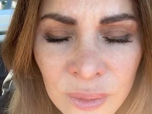 Penampilan Wanita yang Berhenti Suntik Botox Setelah 20 Tahun, Jadi Begini Penampilan Wanita yang Berhenti Suntik Botox Setelah 20 Tahun, Jadi Begini