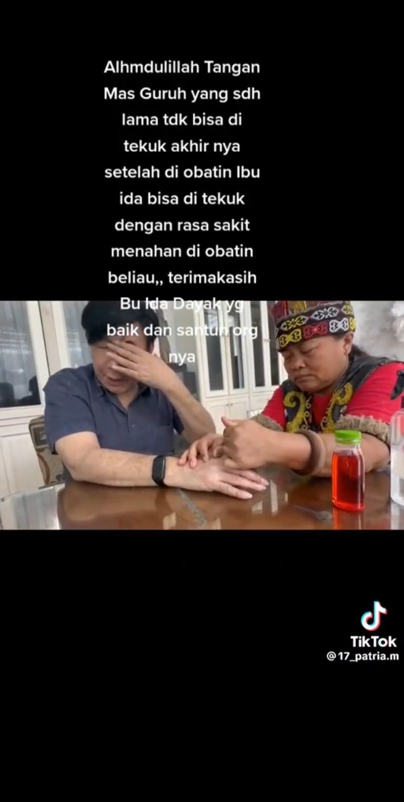 Guruh Soekarnoputra Jadi Pasien Ida Dayak
