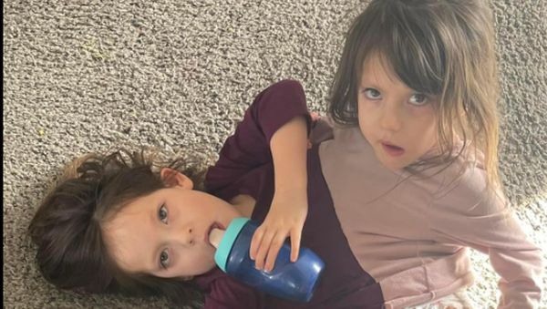 6 Potret Kembar Siam dengan Satu Tubuh, Sempat Disebut Tak Bisa Hidup Lama