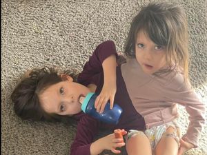 6 Potret Kembar Siam dengan Satu Tubuh, Sempat Disebut Tak Bisa Hidup Lama 6 Potret Kembar Siam dengan Satu Tubuh, Sempat Disebut Tak Bisa Hidup Lama