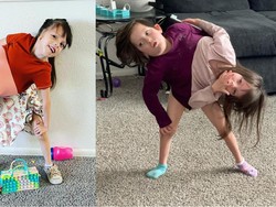 Bikin Haru! Viral Ibu Besarkan Kembar Siam, Sempat Diduga Tak Akan Hidup Lama