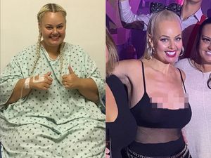 Terinspirasi Barbie, Wanita Ini Diet Hingga Berat Badan Turun 90 Kg