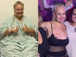 Terinspirasi Barbie, Wanita Ini Diet Hingga Berat Badan Turun 90 Kg