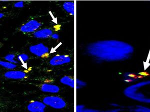 Studi Baru Temukan Otak Bayi Rusak gegara COVID-19, Virus Menembus Plasenta
