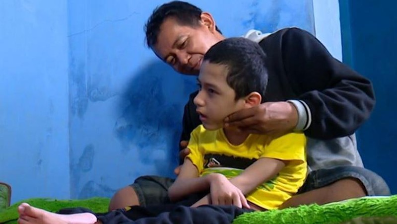 Pilu Anak Kembar Penderita Hidrosefalus hingga Gizi Buruk, Kamu Bisa Bantu