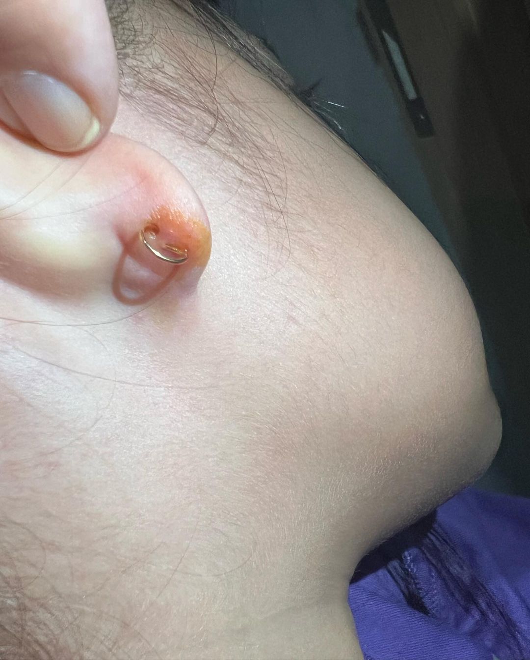 Anting Putri Nycta Gina Menacap di Kulit
