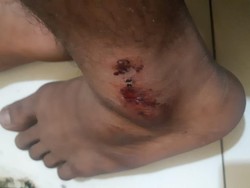 6 Fakta Miris Tahanan Polres Pasuruan Disiksa, Dicambuk hingga Dipaku