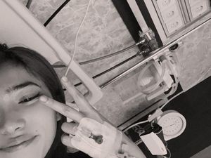 Fakta-fakta Lupus, Penyakit Autoimun yang Diidap Isyana Sarasvati Hingga Bolak-Balik RS