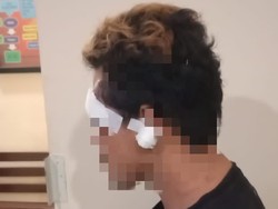 Pesilat Gresik Babak Belur Dihajar 4 Preman Saat Ngopi di Pos Kamling