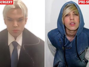 Aktor Ini Meninggal Usai 12 Kali Operasi Plastik Demi Mirip Jimin BTS