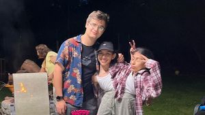 8 Foto Kembar Siam Dempet yang Punya 1 Kelamin, Salah Satunya Punya Pacar