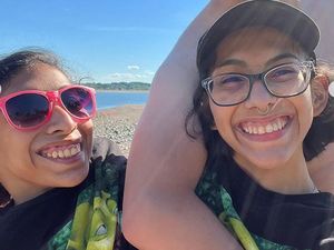 Kisah Kembar Siam Berbagi Kelamin, Hanya Satu yang Sudah Punya Pacar