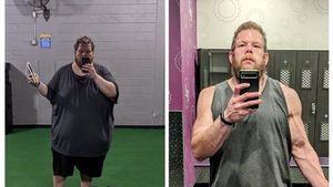 Potret Pria Pangkas BB hingga 152 Kg! Before-Afternya Bikin Merinding