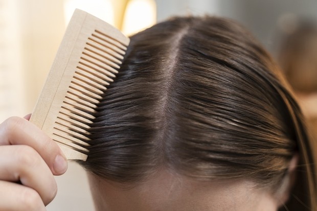 Ilustrasi styling rambut berminyak/Foto: freepik.com