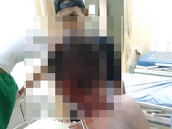 Dua Pemuda di Probolinggo Dibacok hingga Telinganya Nyaris Putus