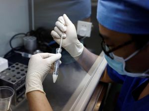 Krisis Populasi, Mahasiswa China Ditawari Rp 12 Juta untuk Sumbangkan Sperma