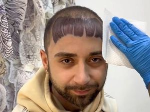 Viral Cowok Botak Bikin Tato Poni, Hasilnya Kocak Jadi Olok-olok Netizen