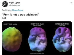 Foto Scan Otak Orang yang Kecanduan Pornografi Ternyata Hoax