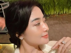 Dewi Perssik Tegaskan Tak Operasi Plastik, Cuma Perawatan