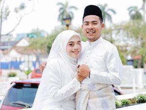 Viral Kisah Cinta Tanpa Syarat, Wanita Bermata Satu Tak Sangka Dapat Jodoh