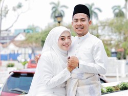 Viral Kisah Cinta Tanpa Syarat, Wanita Bermata Satu Tak Sangka Dapat Jodoh