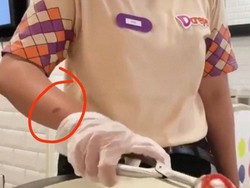 3 Fakta Viral Banyak Pegawai dCrepes Kena Luka Bakar