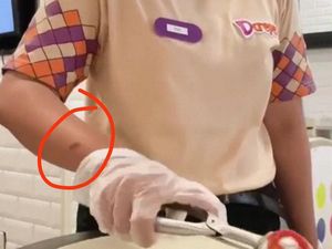 3 Fakta Viral Banyak Pegawai dCrepes Kena Luka Bakar 3 Fakta Viral Banyak Pegawai dCrepes Kena Luka Bakar