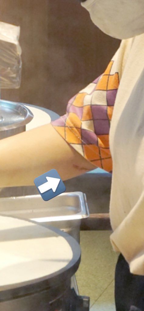 Heboh Tangan Pekerja Ada Bekas Luka, Ini Tanggapan Dcrepes