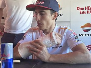 Dokter Ungkap Kondisi Marquez Jelang Comeback, Benar Pulih atau Dipaksakan?
