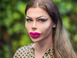 Transgender Jalani 5 Operasi Plastik Sekaligus, Wajah Bonyok Jadi Sorotan