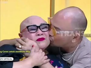 Viral Gaya Caren Delano Lepas Wig Pamer Kepala Plontos, Banjir Pujian Netizen
