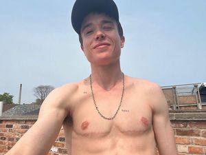 Transgender Elliot Page Tunjukkan Bekas Luka Setelah Operasi Angkat Payudara