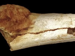 Kasus Kanker Pertama dalam Sejarah, Ditemukan di Fosil Kaki Manusia Purba