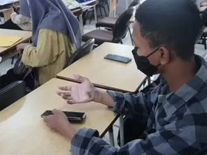 Kisah Peserta UTBK 2023 di Unej, Tahan Sakit Saat Ujian gegara Kecelakaan