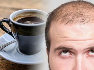 Benarkah Kebiasaan Ngopi Bisa Bikin Rambut Rontok? Ini Penjelasannya