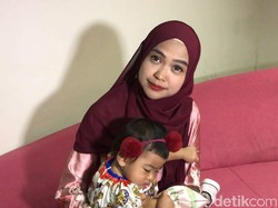 Ketar-ketir Ria Ricis Akan Operasi Hidung karena Sinus