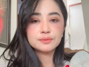 Dewi Perssik Pamer Wajah Tanpa Makeup, Bekas Operasi Bawah Matanya Terlihat Dewi Perssik Pamer Wajah Tanpa Makeup, Bekas Operasi Bawah Matanya Terlihat