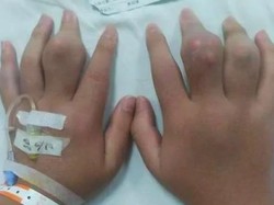 5 Orang Ini Hobi Minum Bubble Tea Berlebihan, Ada yang Koma hingga Lumpuh