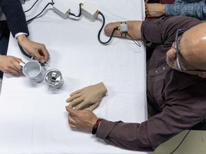 Teknologi Bionik Bantu Orang yang Diamputasi Rasakan Suhu di Tangan Prostetik Teknologi Bionik Bantu Orang yang Diamputasi Rasakan Suhu di Tangan Prostetik