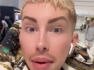 Kebanyakan Oplas Hingga Mirip Wanita, Pria Ini Hampir Tak Bisa Masuk Pesawat