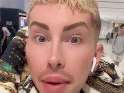 Kebanyakan Oplas Hingga Mirip Wanita, Pria Ini Hampir Tak Bisa Masuk Pesawat