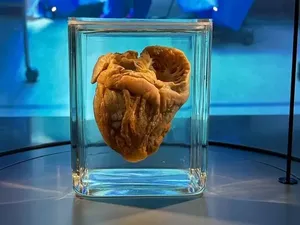 Traveler Melihat Jantungnya Sendiri Dipajang di Museum Traveler Melihat Jantungnya Sendiri Dipajang di Museum