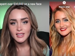 Tak Kenal Wajah Sendiri Usai Keluarkan Rp 448 Juta