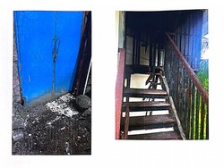 Turis AS yang Jatuh di Hotel di Seminyak Jalani Operasi Intensif