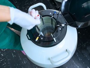 Lagi Ngetren Social Egg Freezing, Apa Sih Itu? Kenali Juga Pro-Kontranya Lagi Ngetren Social Egg Freezing, Apa Sih Itu? Kenali Juga Pro-Kontranya