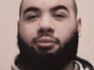 Kisah Pria  yang Terobsesi Mirip Nicki Minaj, Begini Penampilannya Sekarang