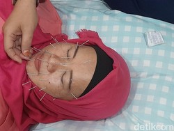 RUU Kesehatan Dinilai Tak Akomodir Pelaku Penyehat Alternatif