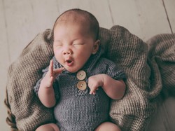 Dosen Prodi Bedah Anak FK Unair Jelaskan soal Khitan Bayi, Adakah Batasan Usia?