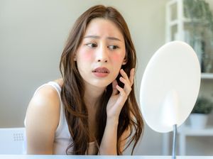 9 Masalah Kulit Wajah yang Paling Sering Dialami Wanita dan Solusinya 9 Masalah Kulit Wajah yang Paling Sering Dialami Wanita dan Solusinya